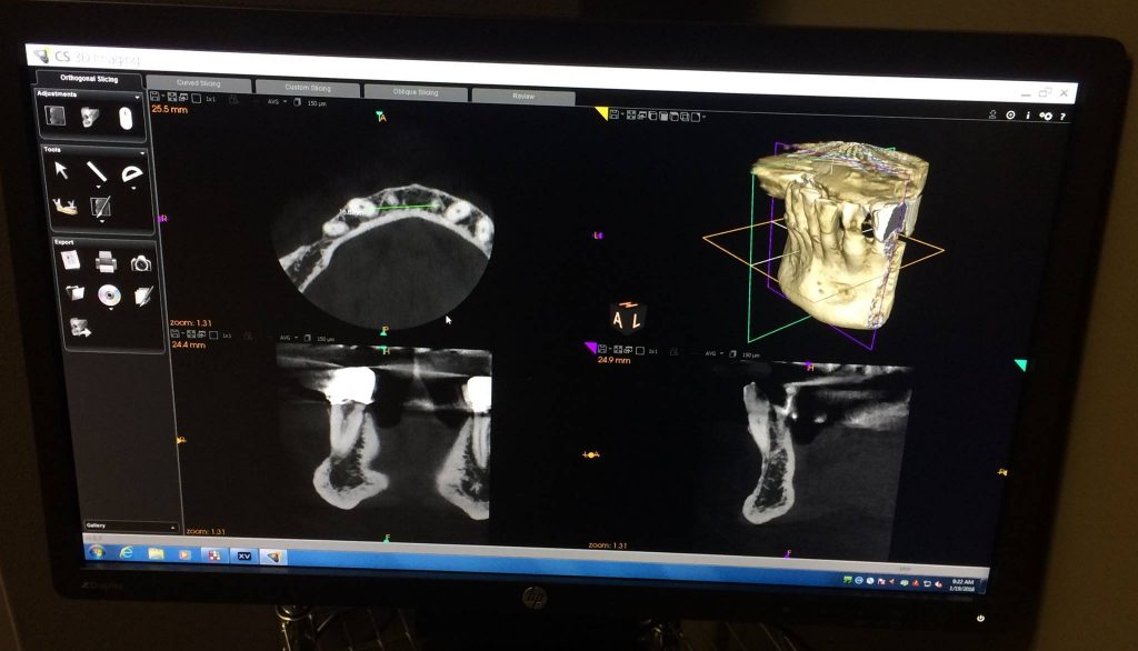 3D Dental Cone Beam CT Scanner Usage in Pittsburgh, PA